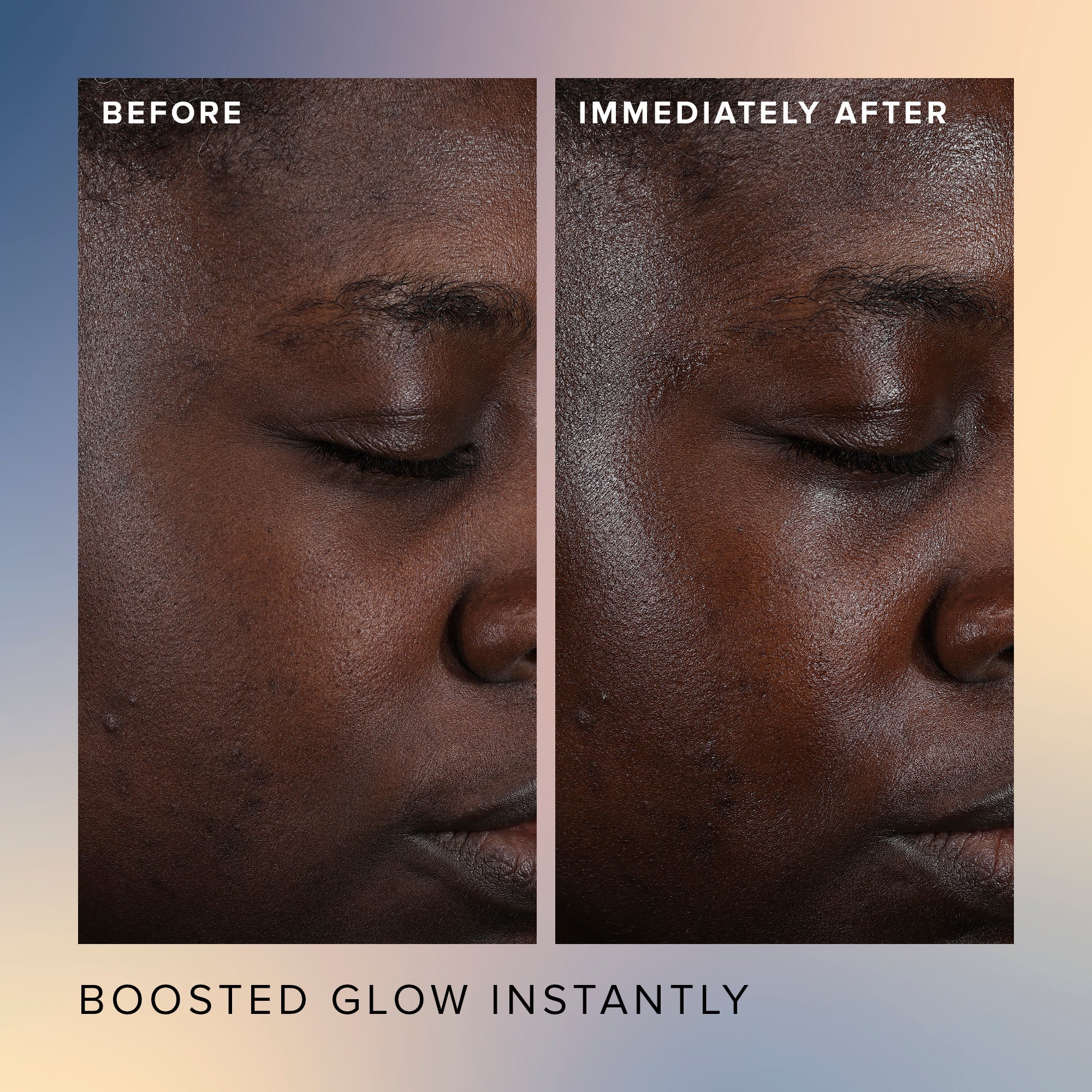 Honey Glow 17% AHA + BHA Resurfacing Acid Serum Gift ($60 Value) - Image 4